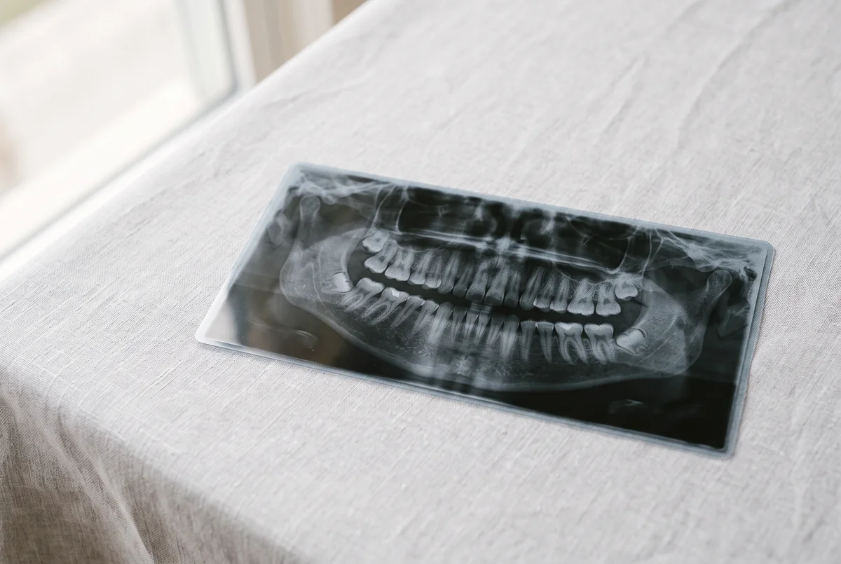 Ortopantomografia costo a Montecatini: cosa comprende — Studi Dentistici Adamanti Montecatini Terme